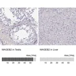 Atlas Antibodies Anti-MAGEB2 Antibody