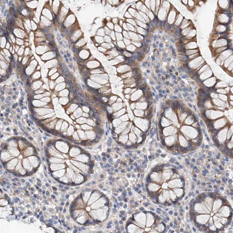 Atlas Antibodies Anti-MAGEE2 Antibody