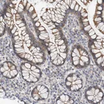 Atlas Antibodies Anti-MAGEE2 Antibody