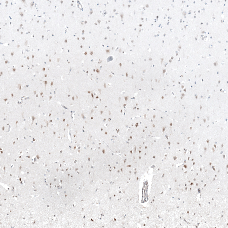 Atlas Antibodies Anti-MAGED4B Antibody