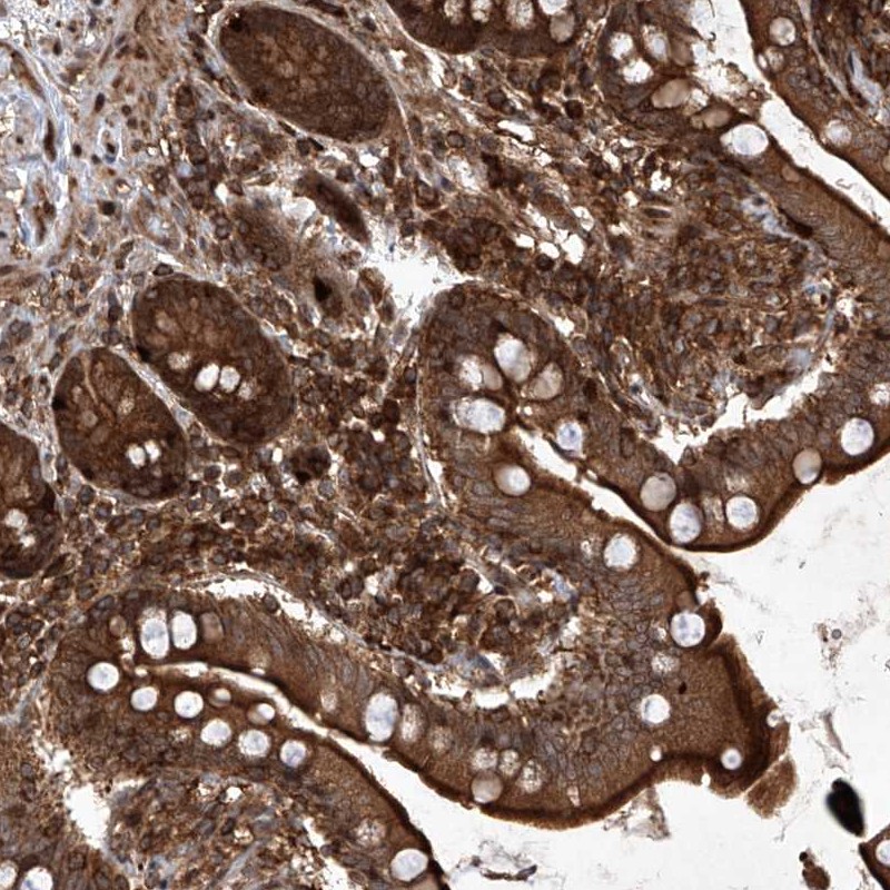 Atlas Antibodies Anti-MAGED2 Antibody