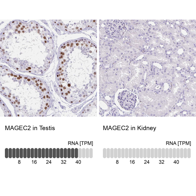 Atlas Antibodies Anti-MAGEC2 Antibody