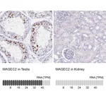Atlas Antibodies Anti-MAGEC2 Antibody