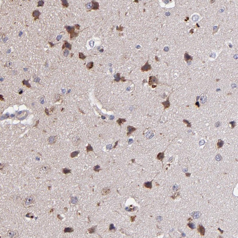 Atlas Antibodies Anti-MAGEE1 Antibody