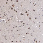 Atlas Antibodies Anti-MAGEE1 Antibody