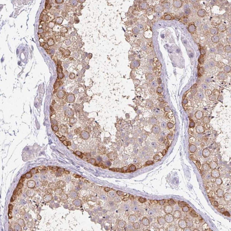 Atlas Antibodies Anti-MAGEC3 Antibody