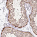 Atlas Antibodies Anti-MAGEC3 Antibody