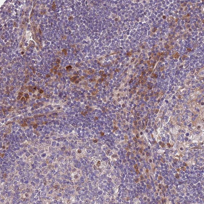 Atlas Antibodies Anti-MAGEF1 Antibody