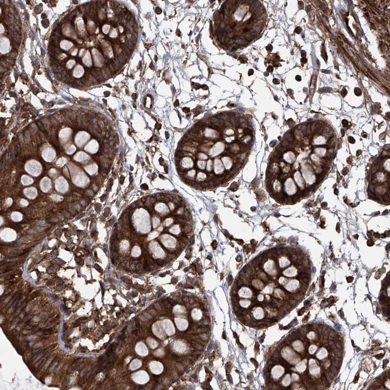 Atlas Antibodies Anti-MAGED2 Antibody