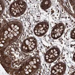 Atlas Antibodies Anti-MAGED2 Antibody