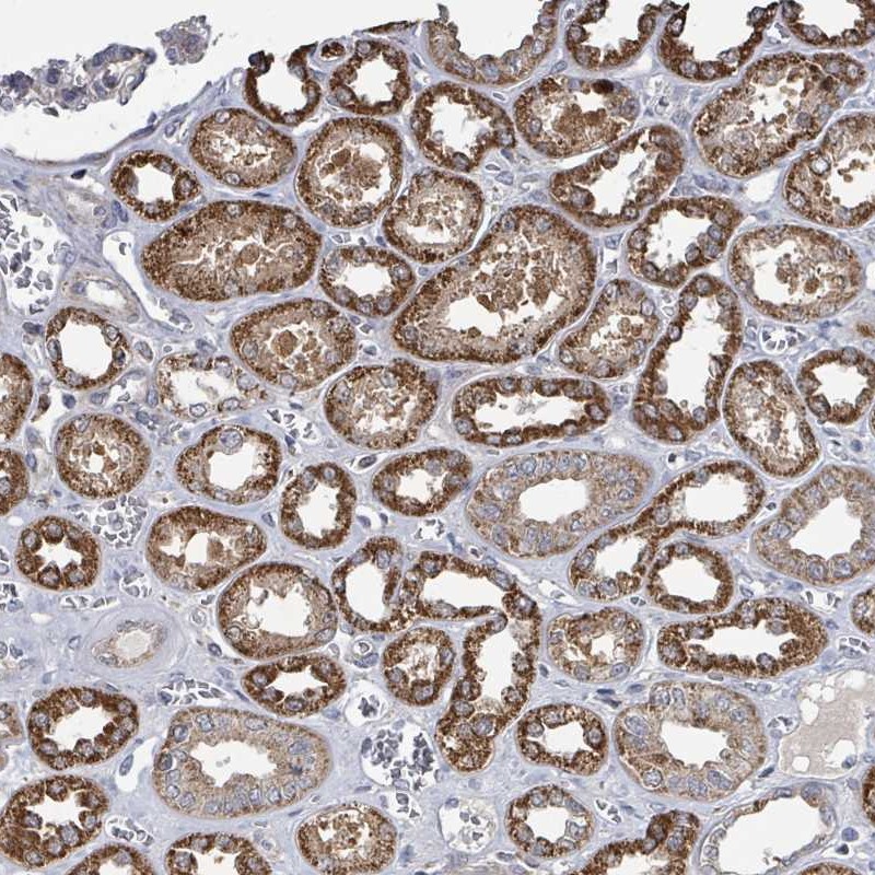 Atlas Antibodies Anti-MAGOH Antibody
