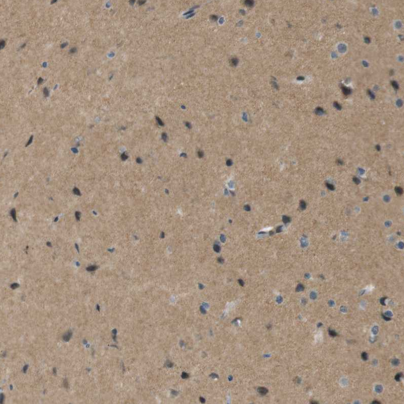Atlas Antibodies Anti-MAGI2 Antibody