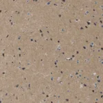 Atlas Antibodies Anti-MAGI2 Antibody