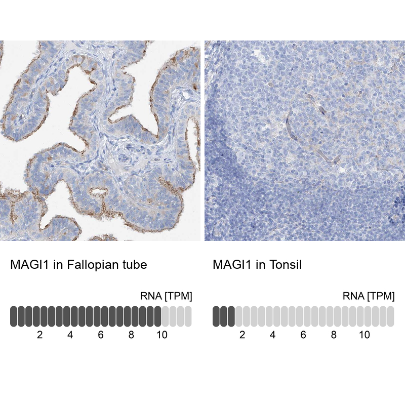 Atlas Antibodies Anti-MAGI1 Antibody