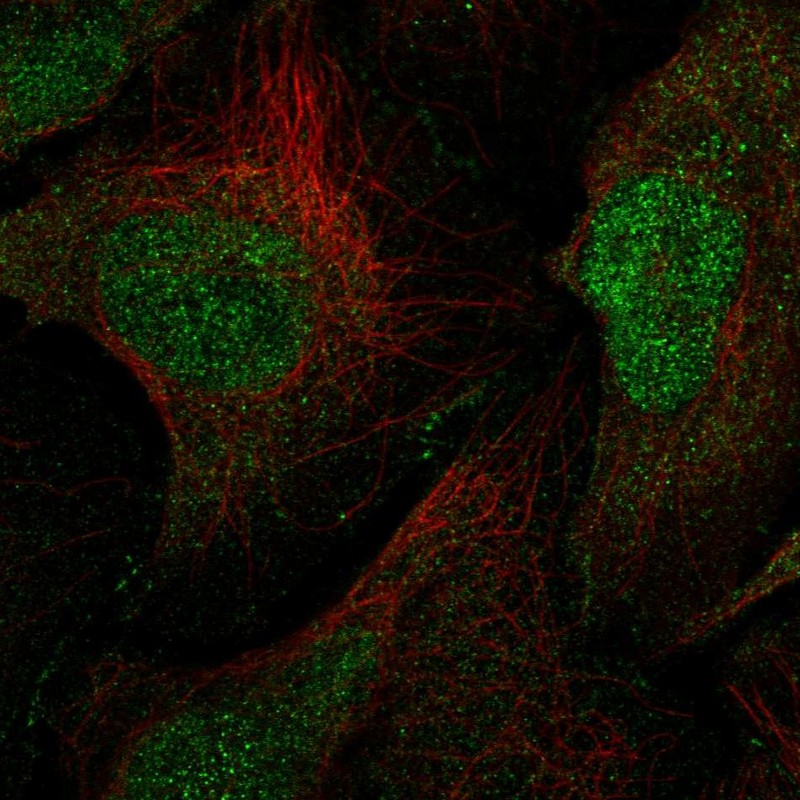 Atlas Antibodies Anti-MAGI1 Antibody