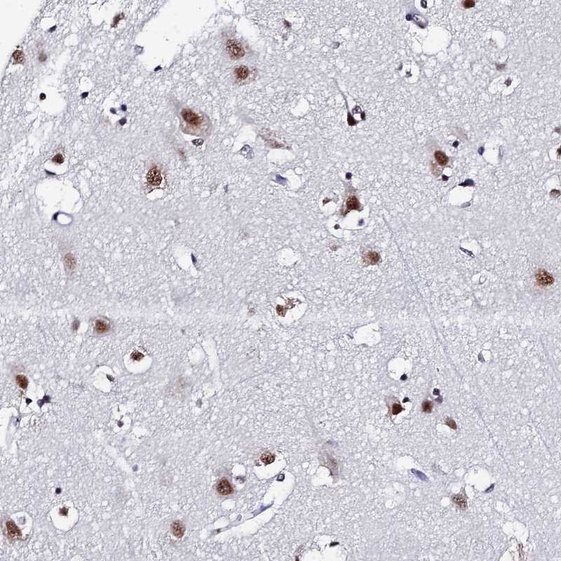 Atlas Antibodies Anti-MAGOH Antibody