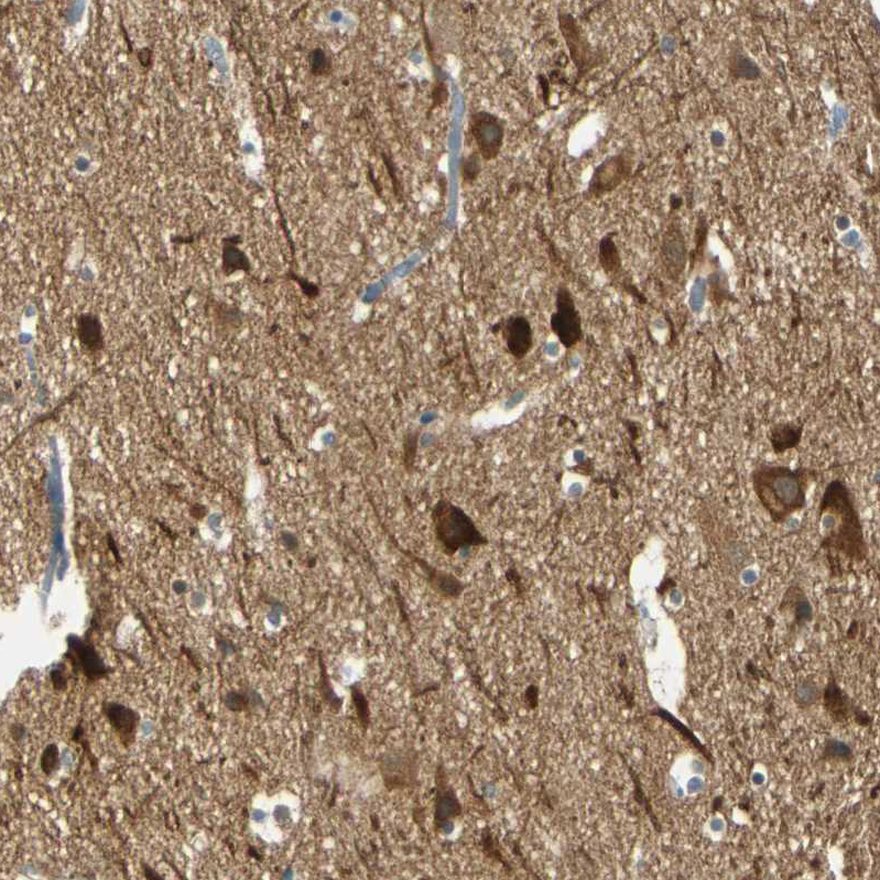 Atlas Antibodies Anti-MAGI3 Antibody