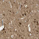 Atlas Antibodies Anti-MAGI3 Antibody