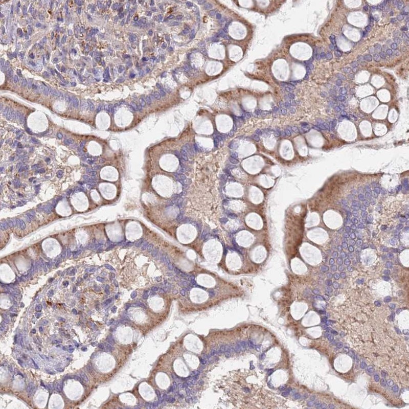 Atlas Antibodies Anti-MALRD1 Antibody