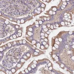 Atlas Antibodies Anti-MALRD1 Antibody