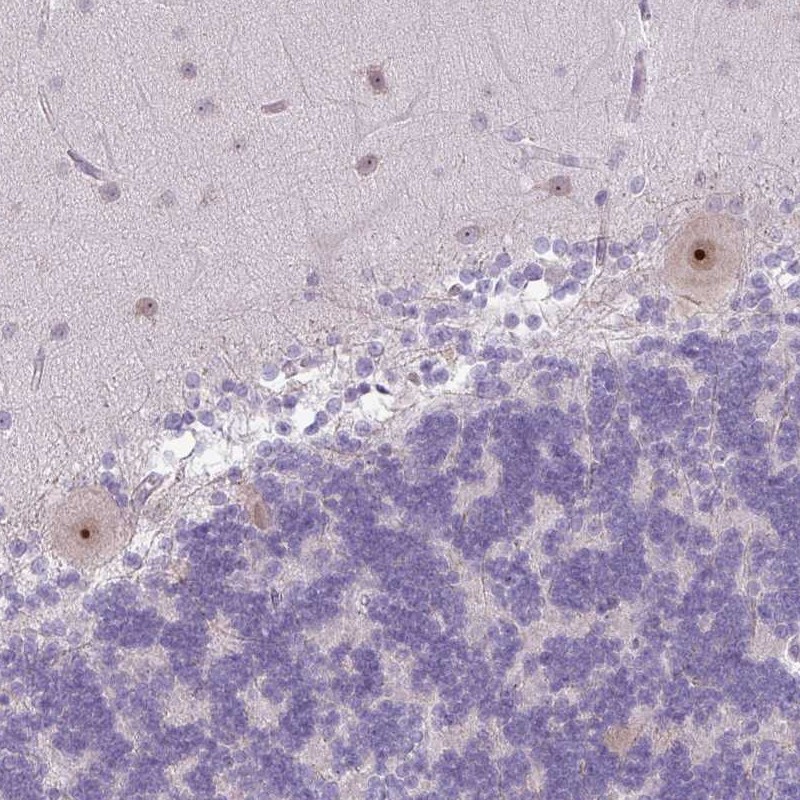 Atlas Antibodies Anti-MAK16 Antibody
