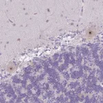 Atlas Antibodies Anti-MAK16 Antibody