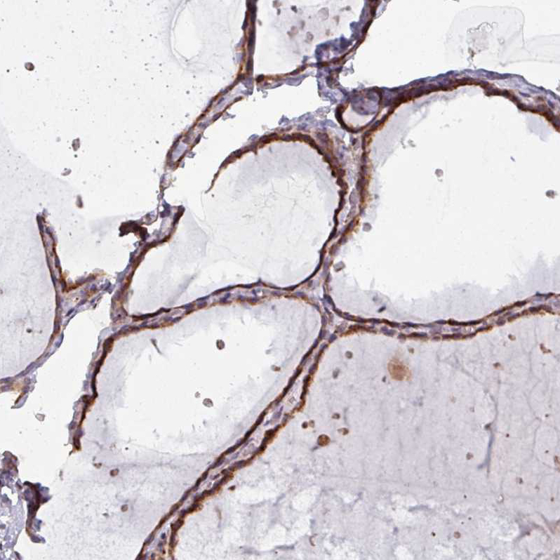 Atlas Antibodies Anti-MAGT1 Antibody