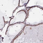 Atlas Antibodies Anti-MAGT1 Antibody