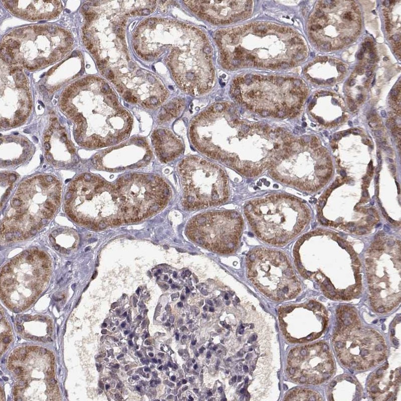 Atlas Antibodies Anti-MAIP1 Antibody