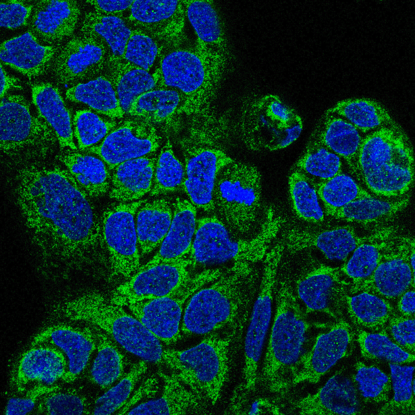 Atlas Antibodies Anti-MAIP1 Antibody