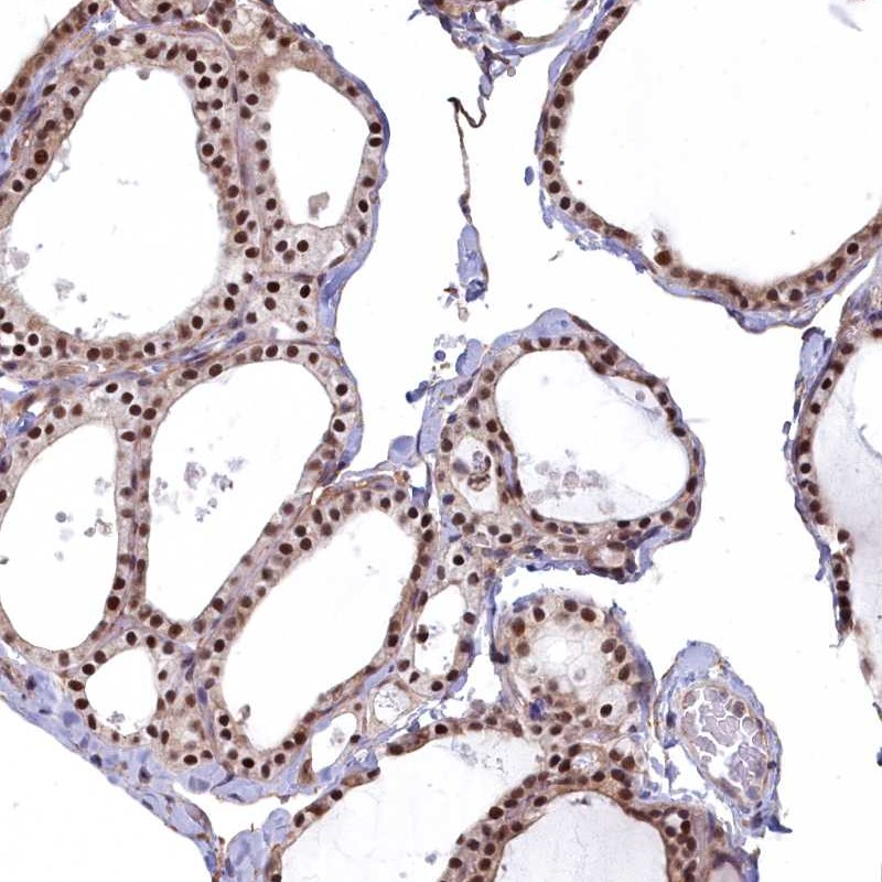 Atlas Antibodies Anti-MAK16 Antibody