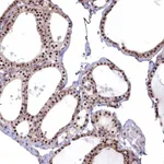 Atlas Antibodies Anti-MAK16 Antibody