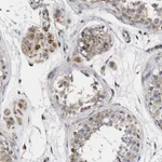 Atlas Antibodies Anti-MALSU1 Antibody
