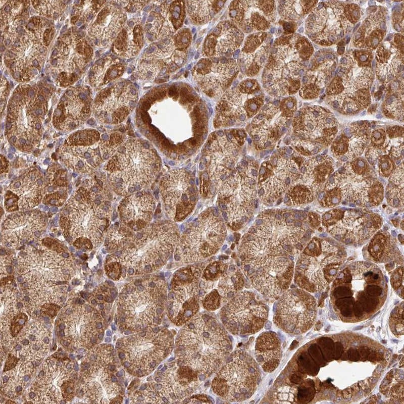 Atlas Antibodies Anti-MALSU1 Antibody