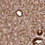 Atlas Antibodies Anti-MALSU1 Antibody