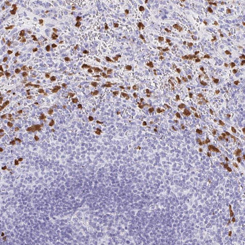 Atlas Antibodies Anti-MAMDC4 Antibody