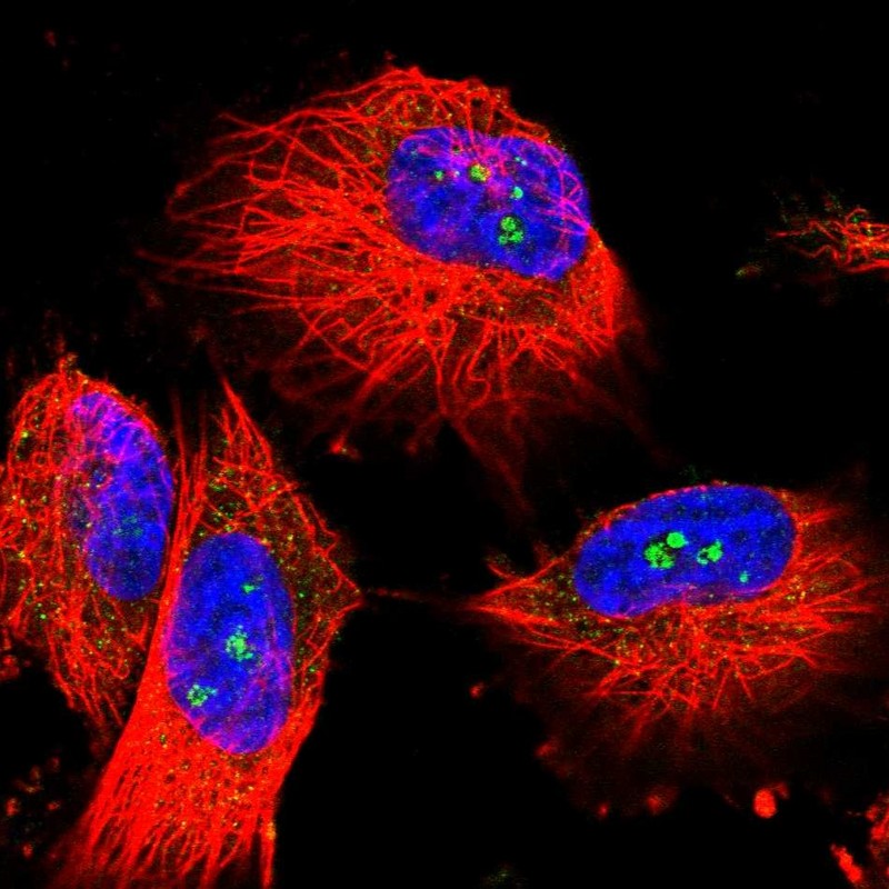 Atlas Antibodies Anti-MALT1 Antibody