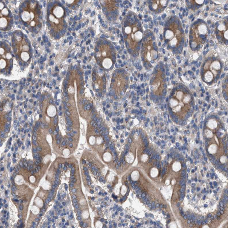Atlas Antibodies Anti-MAMDC2 Antibody