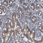 Atlas Antibodies Anti-MAMDC2 Antibody