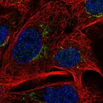 Atlas Antibodies Anti-MAN1A2 Antibody