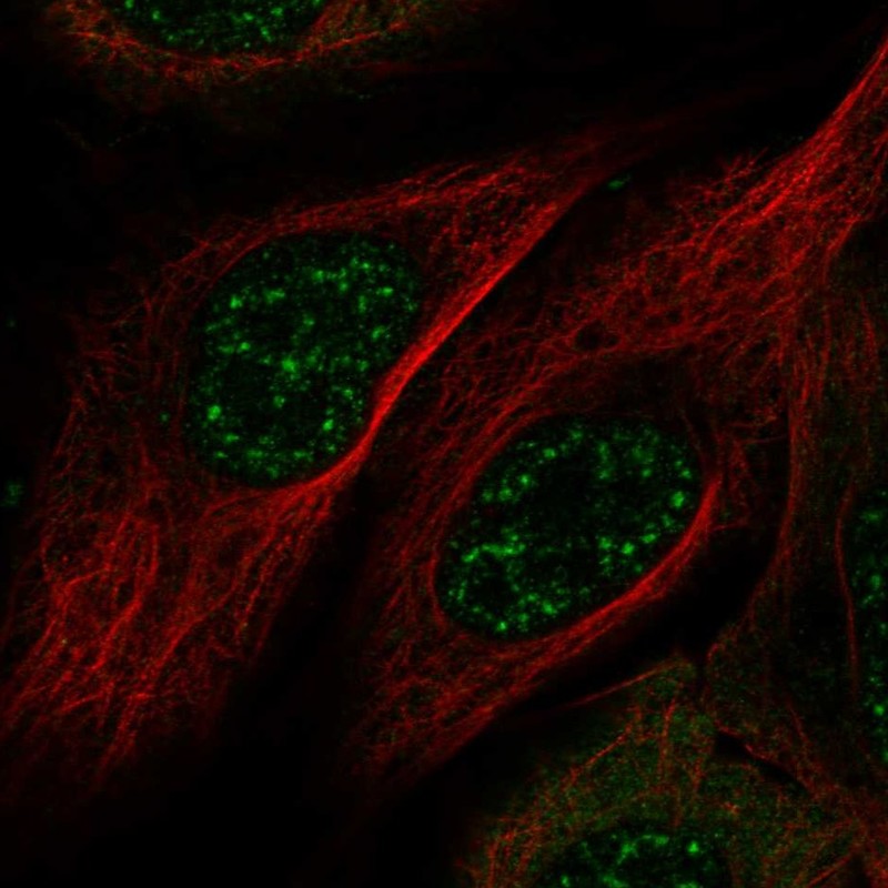 Atlas Antibodies Anti-MAMSTR Antibody