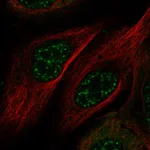Atlas Antibodies Anti-MAMSTR Antibody