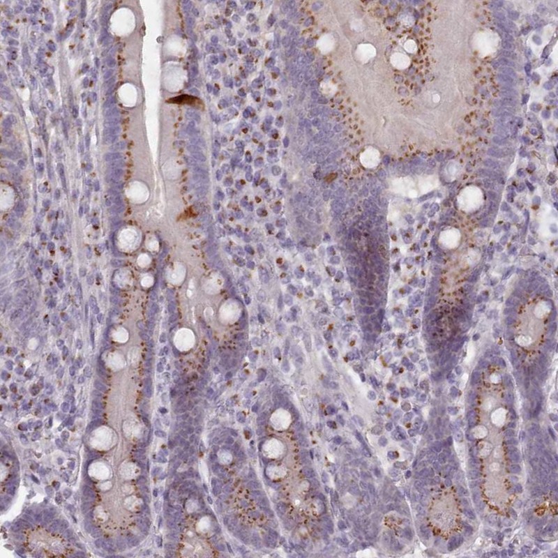 Atlas Antibodies Anti-MAN1B1 Antibody