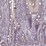 Atlas Antibodies Anti-MAN1B1 Antibody