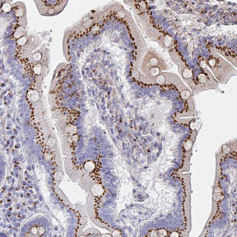 Atlas Antibodies Anti-MAN1A1 Antibody