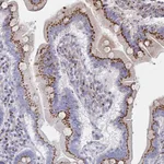 Atlas Antibodies Anti-MAN1A1 Antibody