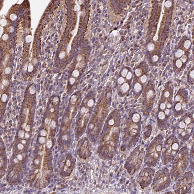 Atlas Antibodies Anti-MAN1A1 Antibody