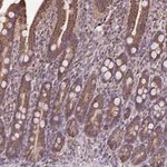 Atlas Antibodies Anti-MAN1A1 Antibody