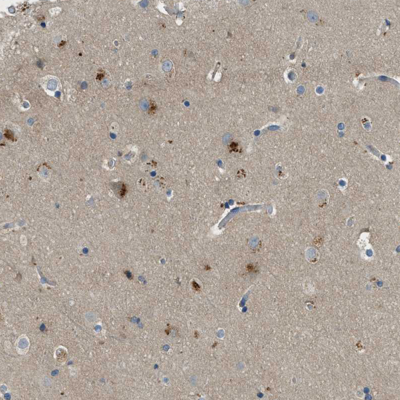 Atlas Antibodies Anti-MAN2A2 Antibody