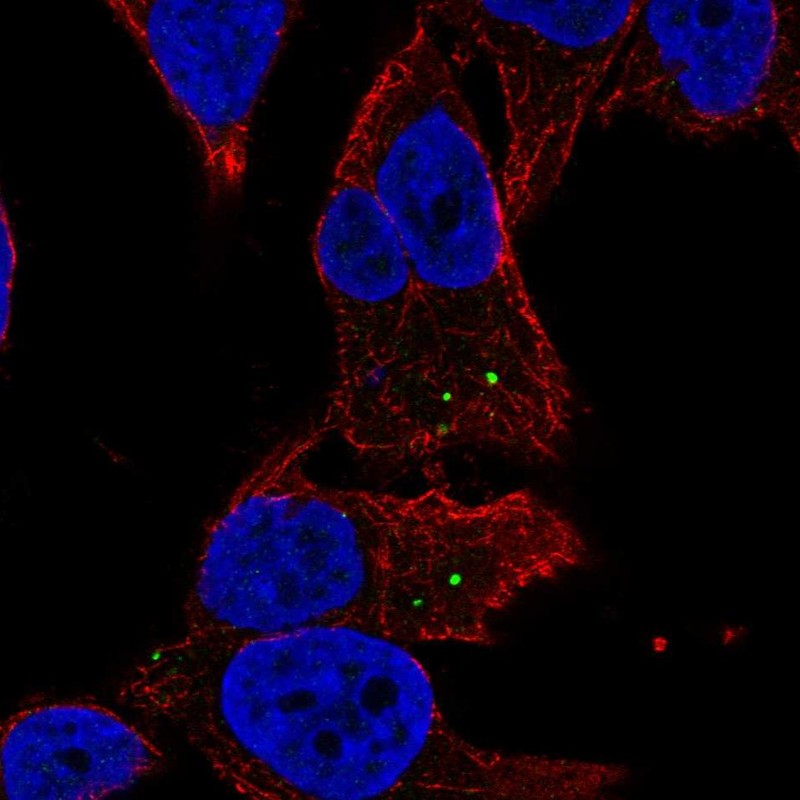 Atlas Antibodies Anti-MAN2A2 Antibody